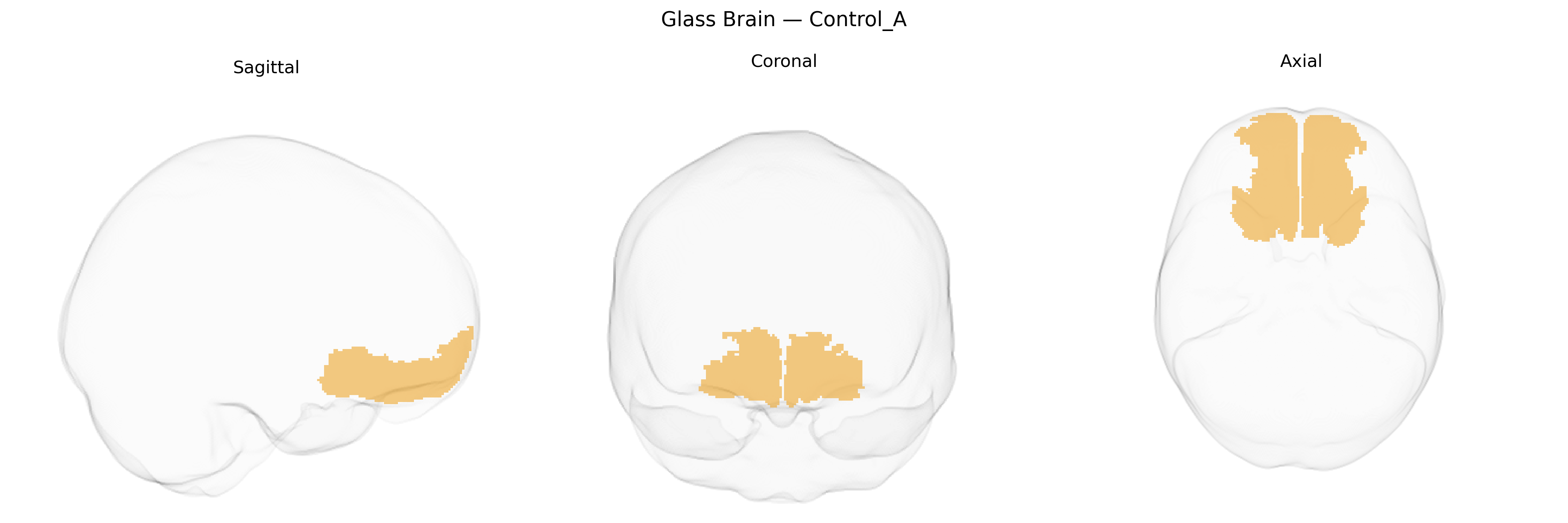 Triplanar Ghost Brain