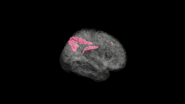 Full Brain Black