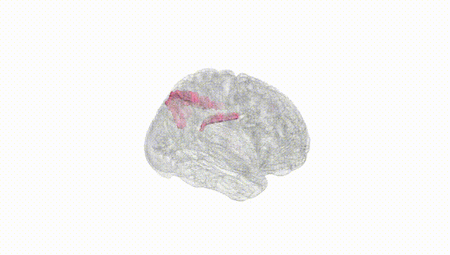 Full Brain White