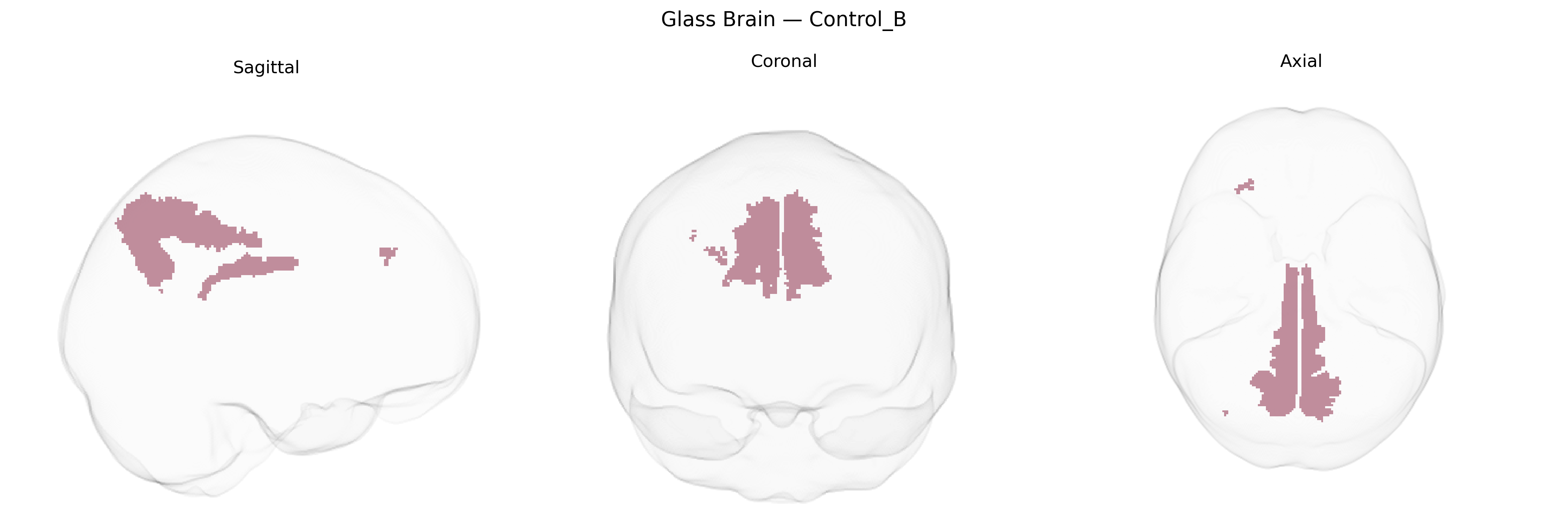 Triplanar Ghost Brain