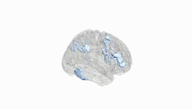 Full Brain White
