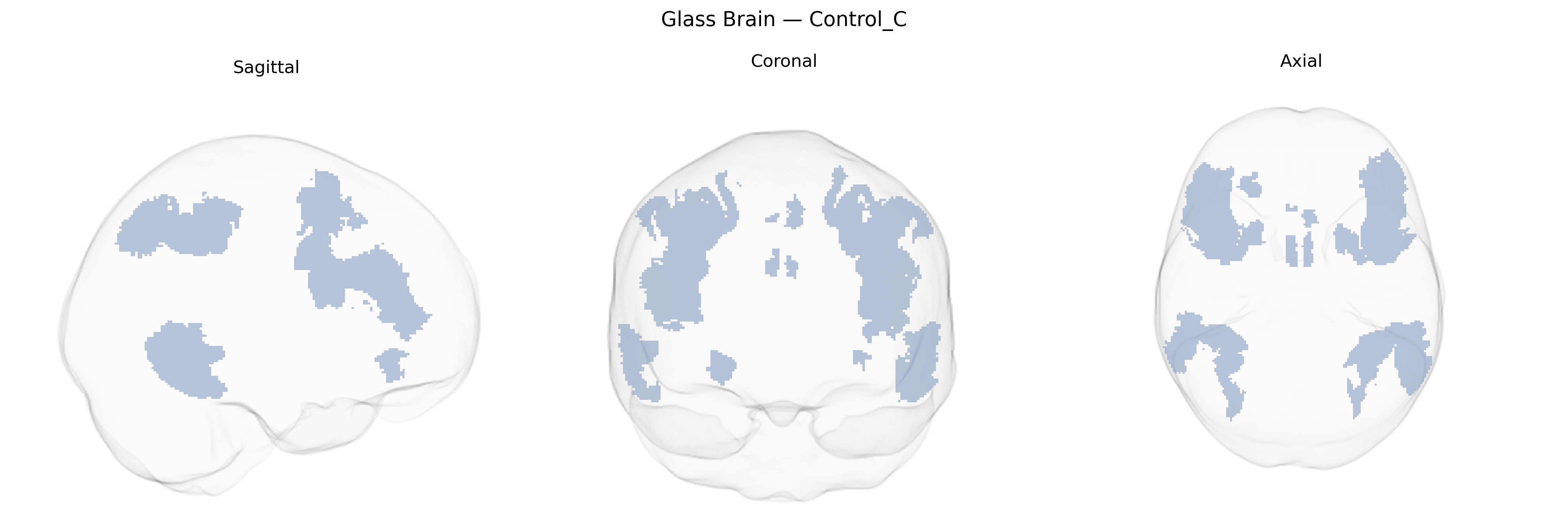 Triplanar Ghost Brain