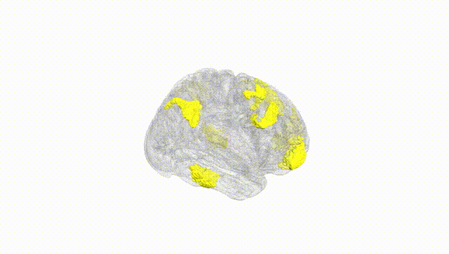Full Brain White