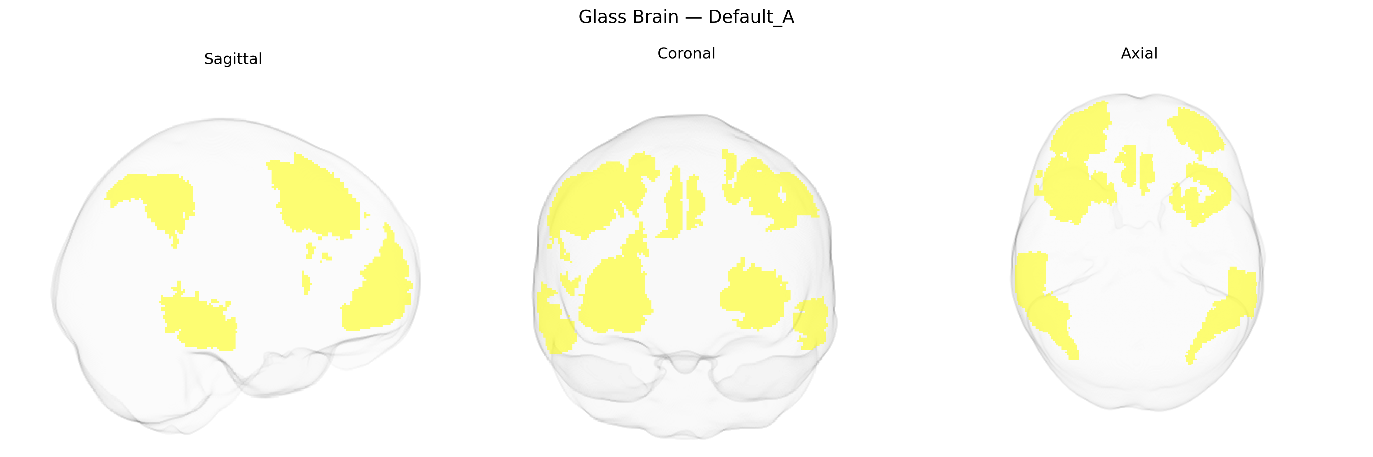Triplanar Ghost Brain