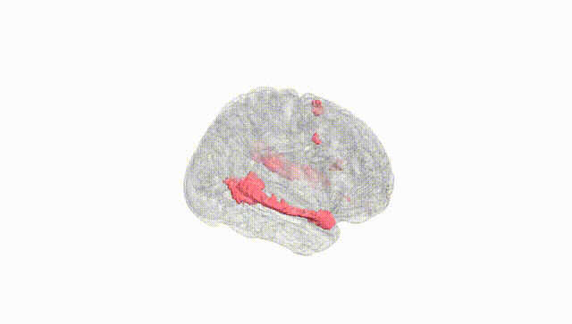 Full Brain White