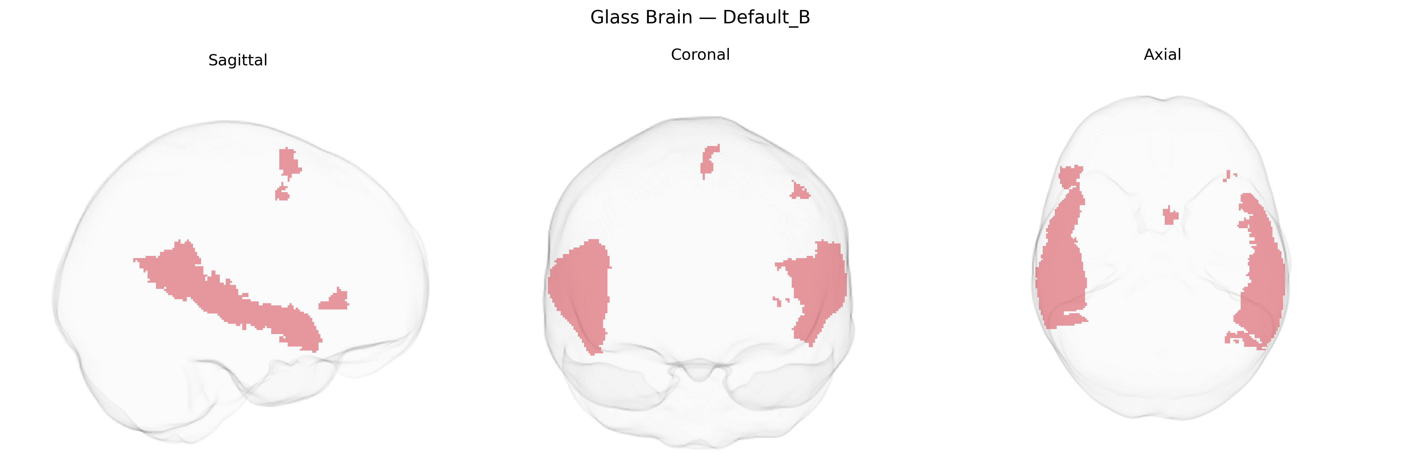 Triplanar Ghost Brain