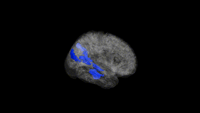 Full Brain Black
