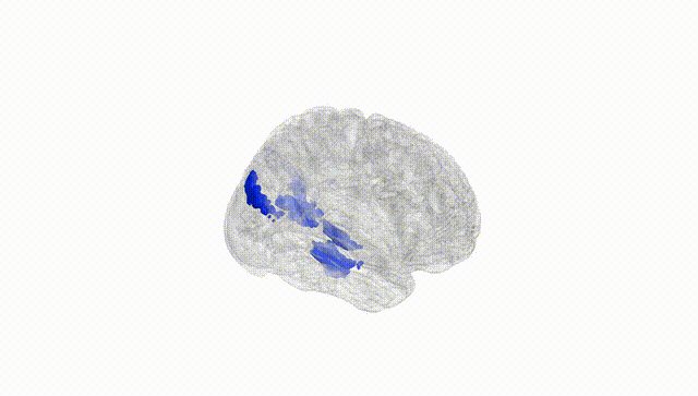 Full Brain White