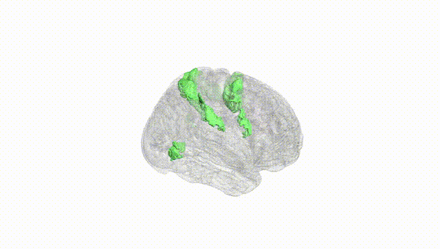 Full Brain White