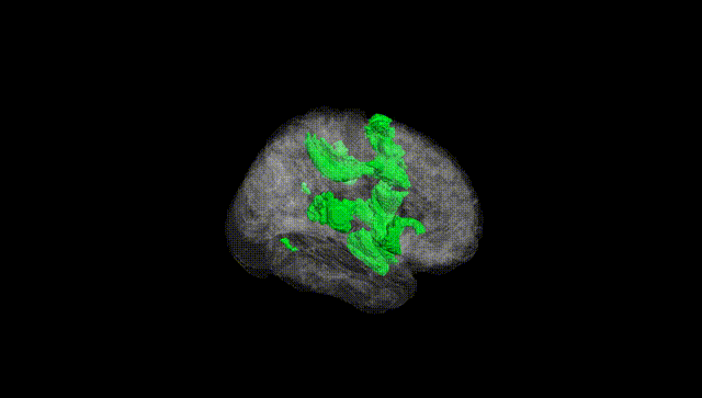 Full Brain Black