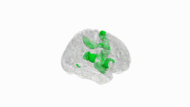 Full Brain White