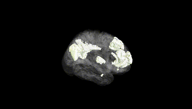 Full Brain Black