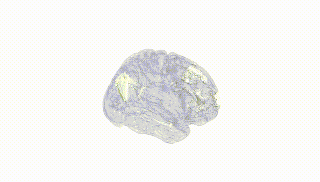 Full Brain White