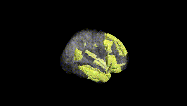Full Brain Black