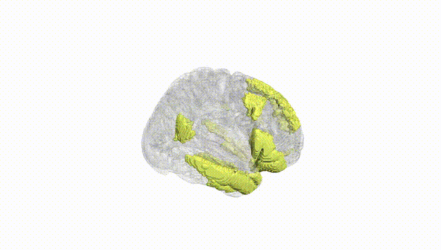 Full Brain White