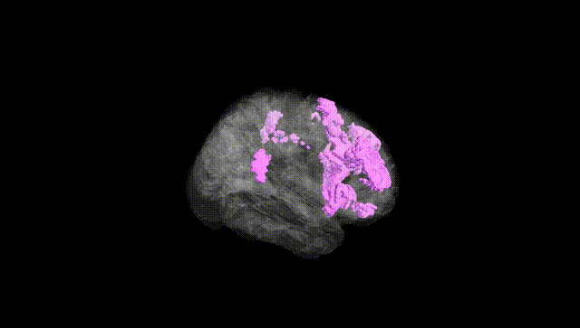 Full Brain Black