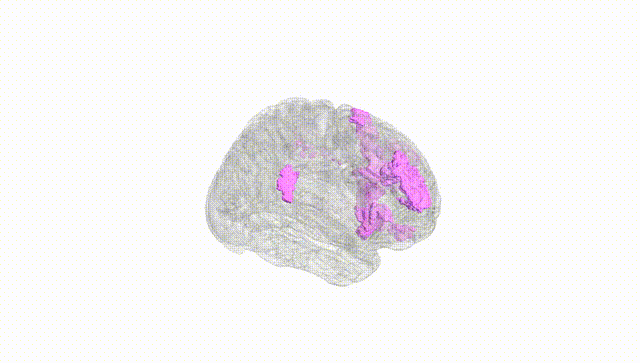 Full Brain White