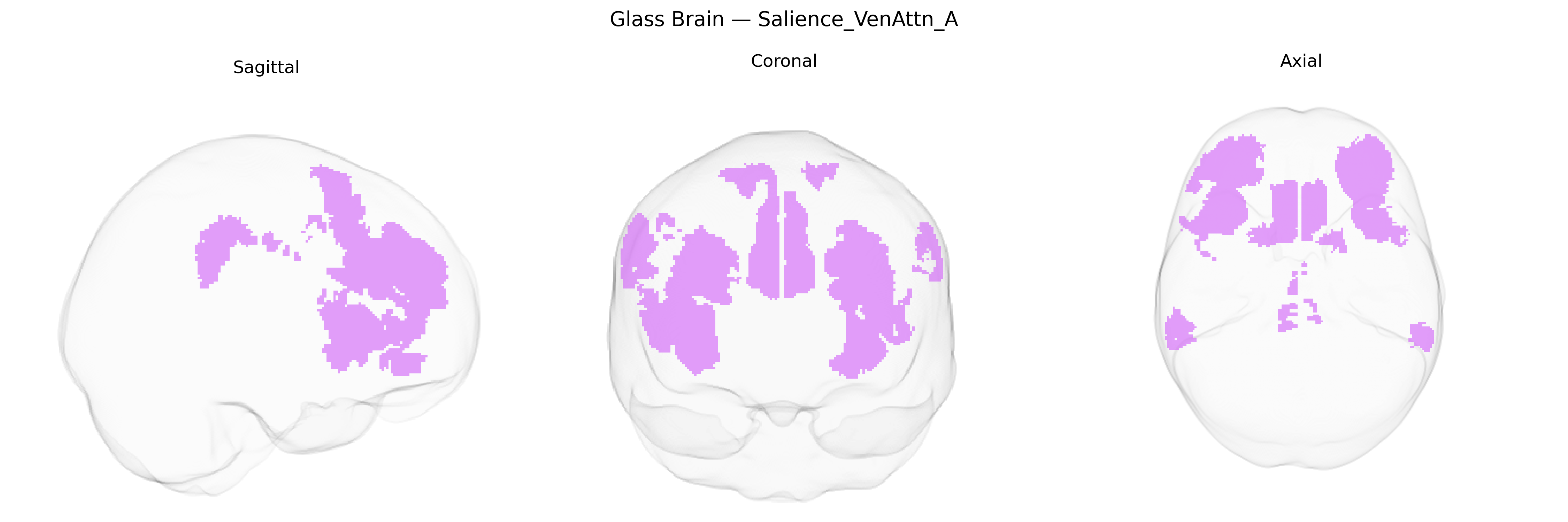 Triplanar Ghost Brain