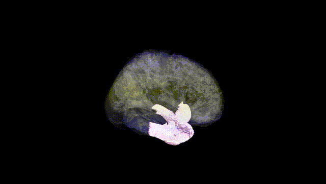 Full Brain Black
