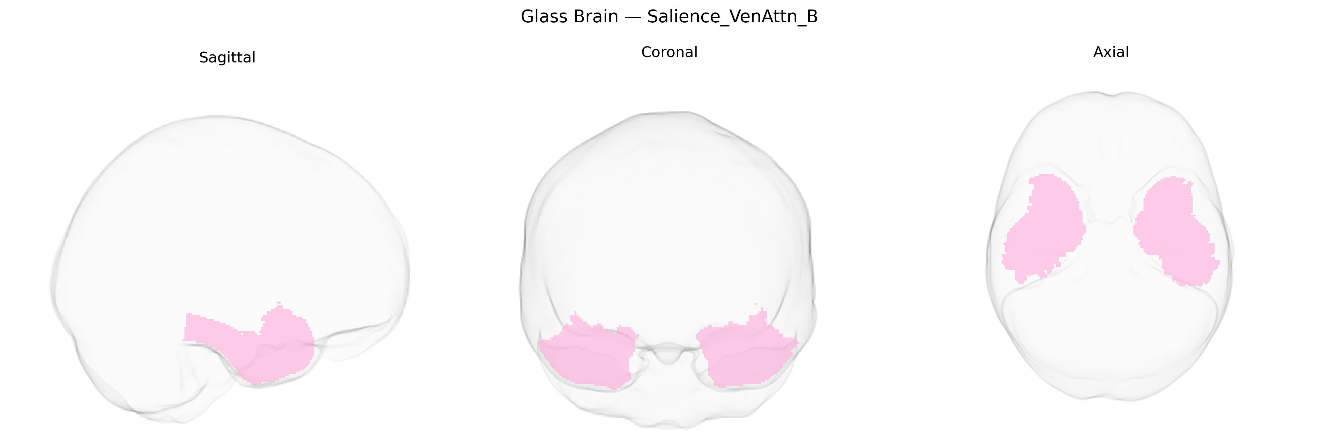 Triplanar Ghost Brain