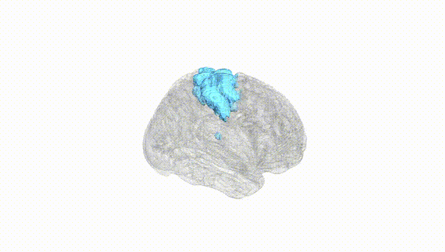 Full Brain White