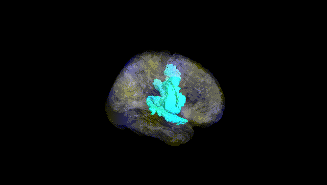 Full Brain Black