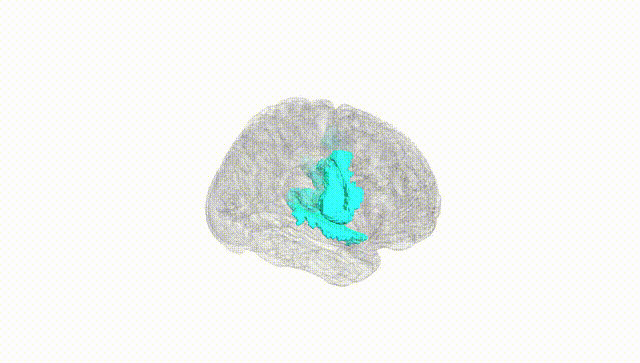 Full Brain White