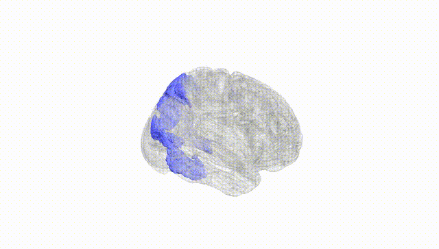 Full Brain White