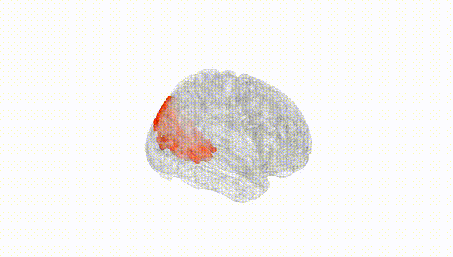 Full Brain White