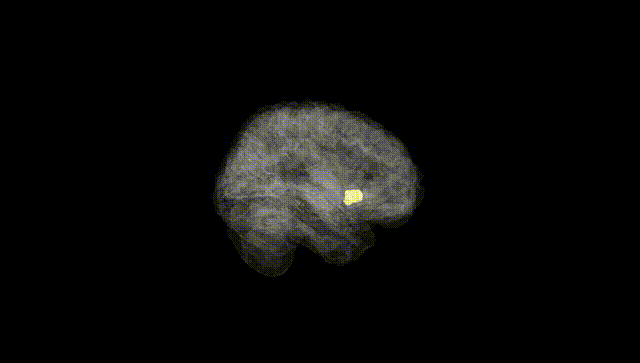 Full Brain Black