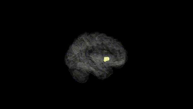 Hemisphere Black