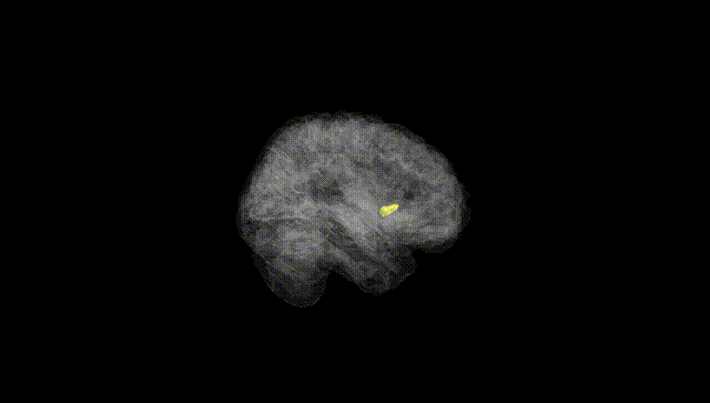 Full Brain Black