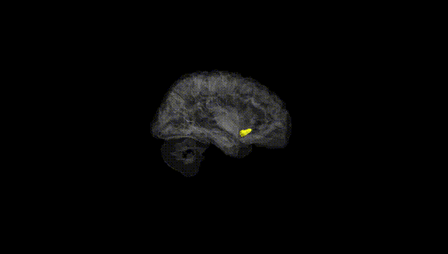 Hemisphere Black