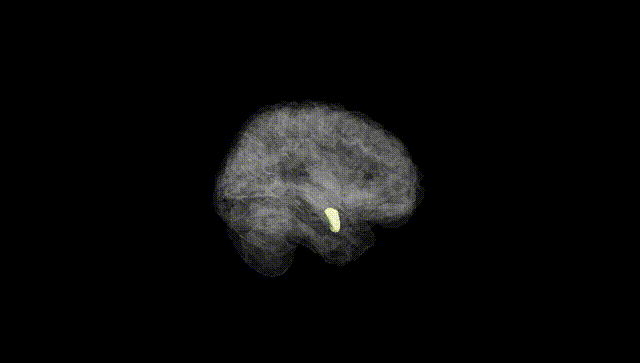 Full Brain Black
