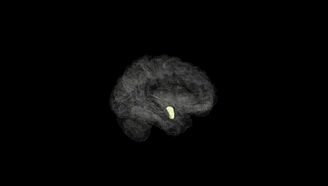 Hemisphere Black