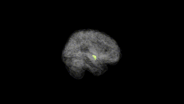 Full Brain Black