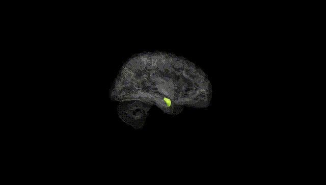 Hemisphere Black