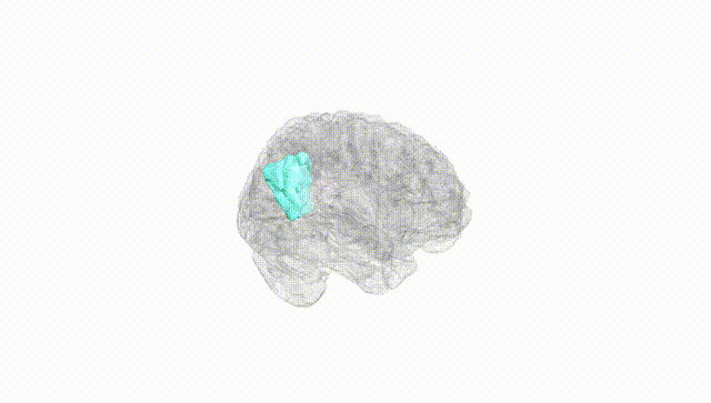 Full Brain White