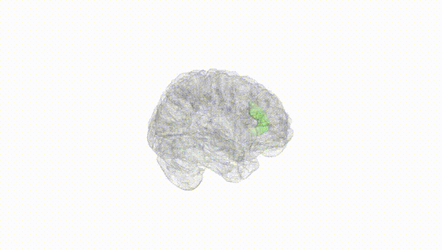 Full Brain White