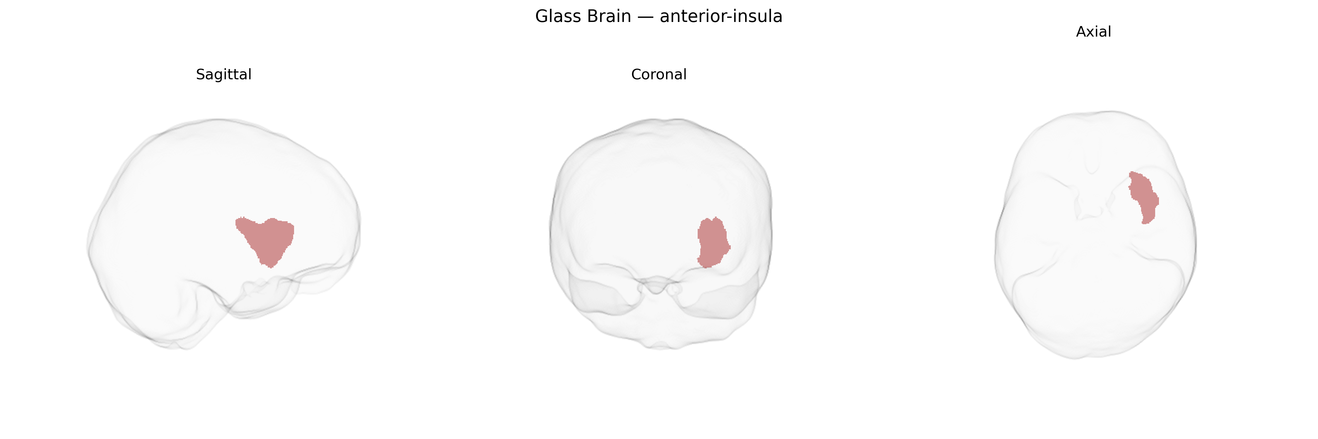 Triplanar Ghost Brain
