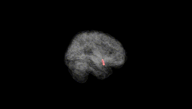 Full Brain Black