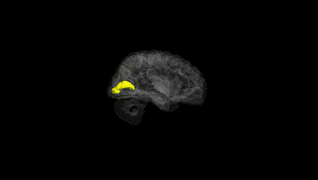 Hemisphere Black