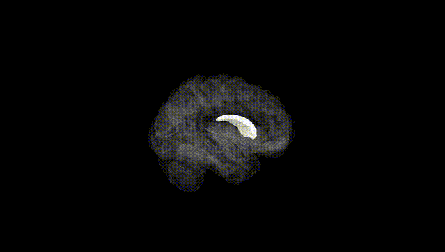 Hemisphere Black