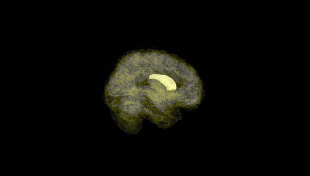 Full Brain Black