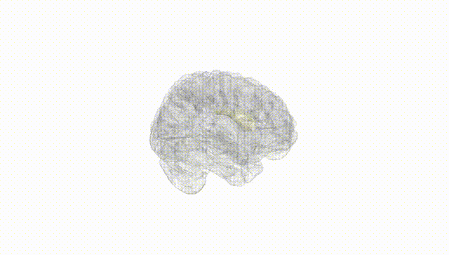 Full Brain White