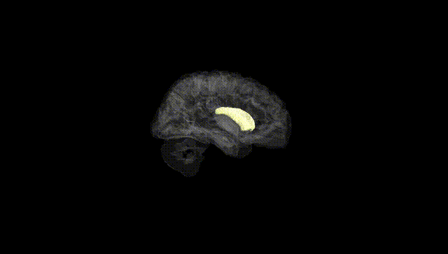 Hemisphere Black