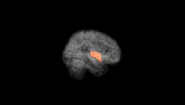 Full Brain Black