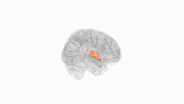 Full Brain White