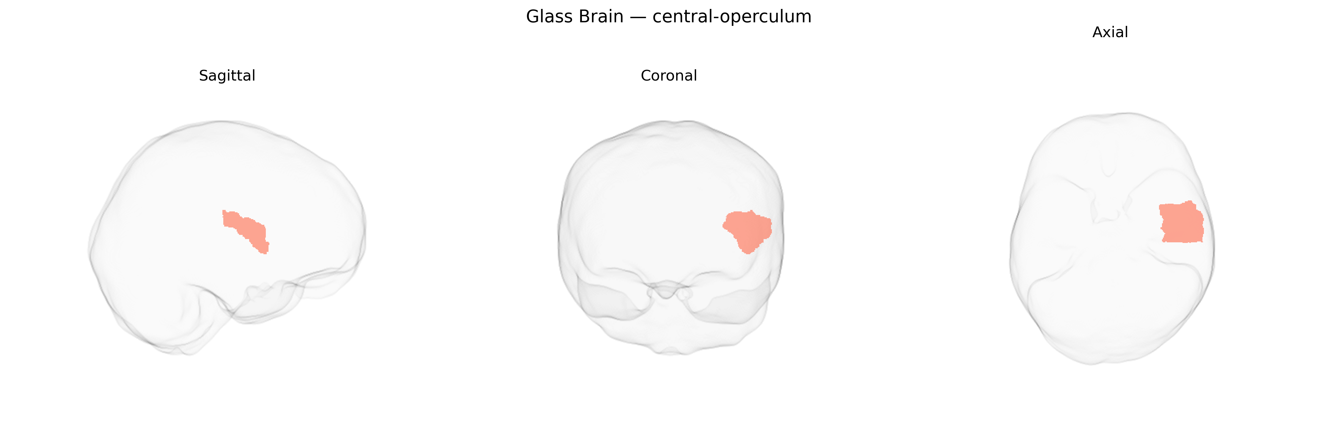 Triplanar Ghost Brain