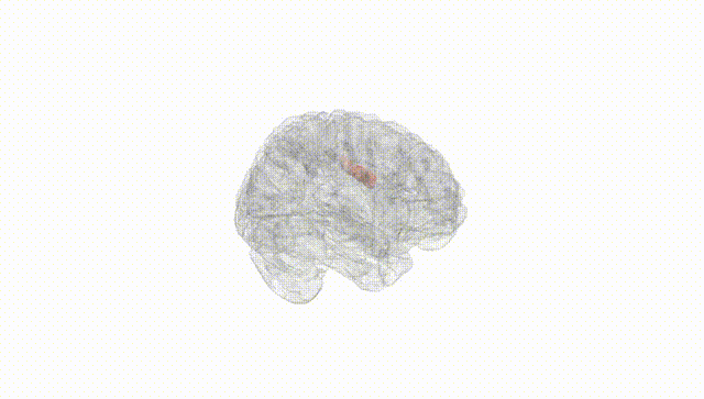 Full Brain White